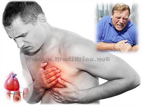 COMO SOBREVIVER A UM ATAQUE CARDÍACO QUANDO SOZINHO